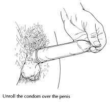 Proper Condom Use