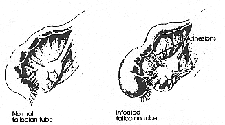 infected reproductive structures