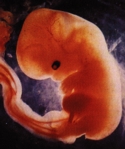six week embryo